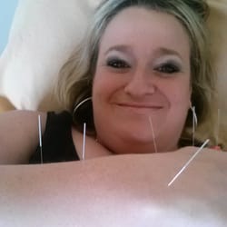 Central Acupuncture and Health - Wasn't painful at all!