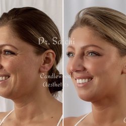 Candlewood Aesthetics & Laser Medspa Wellness Center