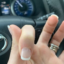 Horribly painful bleeding cuticles Horribly painful bleeding cuticles