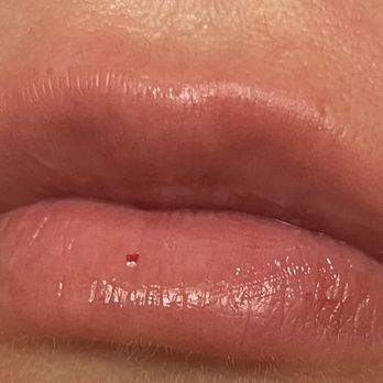 Ambience Experience - After - Medical Spas Near Me