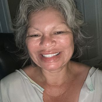 Darce A Slate, DDS - Pure Dentistry - After work - General Dentistry Near Me - Rocklin, California Darce A Slate, DDS - Pure Dentistry - After work - General Dentistry Near Me - Rocklin, California