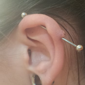 Body Jewelry Plus - Side view of the ear. Very sollowen. You can tell the bar is to big. - Piercing Near Me - Auburn, Washington