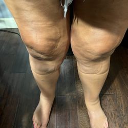 Lawrence Memorial Hospital - Legs