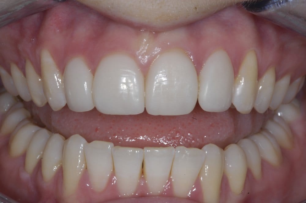 AMBRIDGE CERAMICS DENTAL LABORATORY 11 Photos Low Mill Road, Ripon