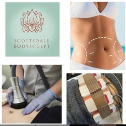 Scottsdale BodySculpt
