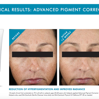 Crave Med Spa - SkinCeuticals Advanced Pigment Corrector - Medical Spas Near Me - Atascocita, Texas Crave Med Spa - SkinCeuticals Advanced Pigment Corrector - Medical Spas Near Me - Atascocita, Texas