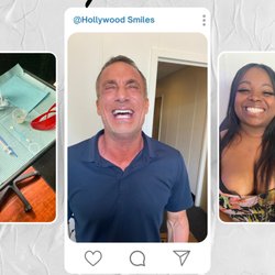 Hollywood Smiles Teeth Whitening