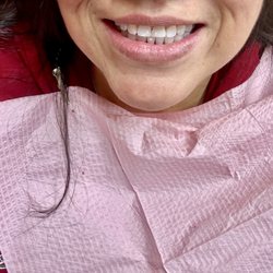 Crystal City Dental Arts Center - After a good cleaning and thorough examination.