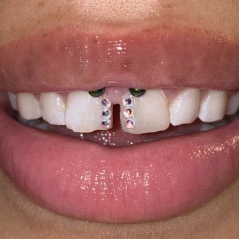 Kalassygems - Let's create your own unique design! - Teeth Whitening Near Me Kalassygems - Let's create your own unique design! - Teeth Whitening Near Me