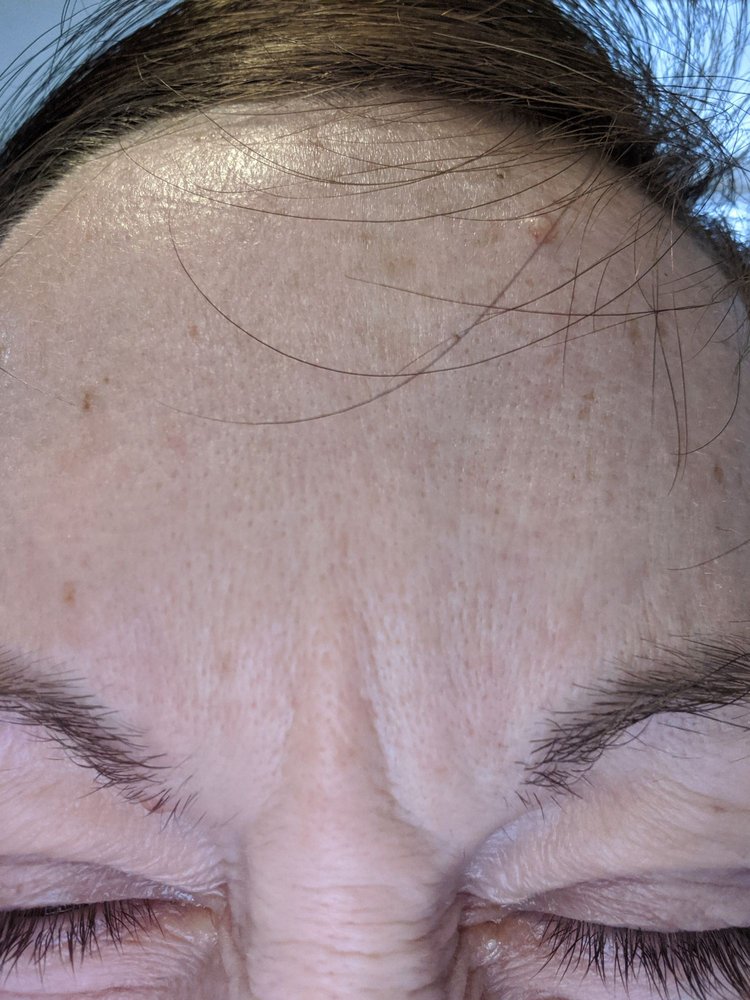 ABSOLUTE FACE AND BODY & MED SPA Updated May 2024 31 Photos 1340