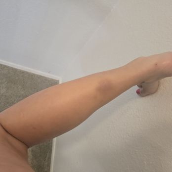 Happy Foot - Would not be bruised this way. Not a big woman. I do workout and seeing the other bruises on two members. - Massage Near Me - Murphy, Texas Happy Foot - Would not be bruised this way. Not a big woman. I do workout and seeing the other bruises on two members. - Massage Near Me - Murphy, Texas
