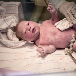 The Tidal Doula - Image: A newborn baby on an infant warmer. The baby is unclothed and pink, and they are looking up while their body is covered in a white ch