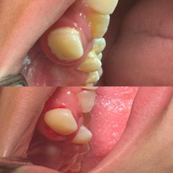Little Smiles of Beverly Hills - A bright clean smile after a thorough professional cleaning, revealing healthy and sparkling teeth.