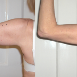 Strawberry Laser Lipo of Kissimmee