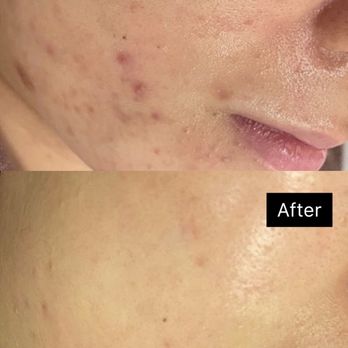 Oz Esthetic - Skin Care Near Me - Vienna, Virginia