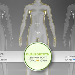 Paul J. Mackoul, MD - The DualPortGYN approach is used for most GYN procedures at CIGC. Learn more: https://innovativegyn.com/techniques/dualportgyn/