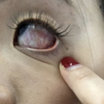 K-Beauty Studio - Eye infection 6 hours after extension appointment - Skin Care Near Me - New York, New York K-Beauty Studio - Eye infection 6 hours after extension appointment - Skin Care Near Me - New York, New York