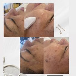 Remake Beauty Studio - Euless - Facial Tuesday $45