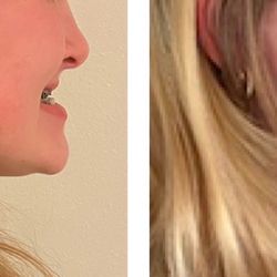 Inspired Orthodontics- Bellevue