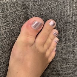 Right big toe cuticle infection from pedicure Right big toe cuticle infection from pedicure