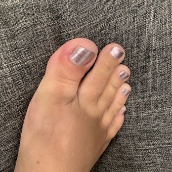 Envy Nails Spa - Right big toe cuticle infection from pedicure - Nail Salons Near Me - Cypress, Texas Envy Nails Spa - Right big toe cuticle infection from pedicure - Nail Salons Near Me - Cypress, Texas