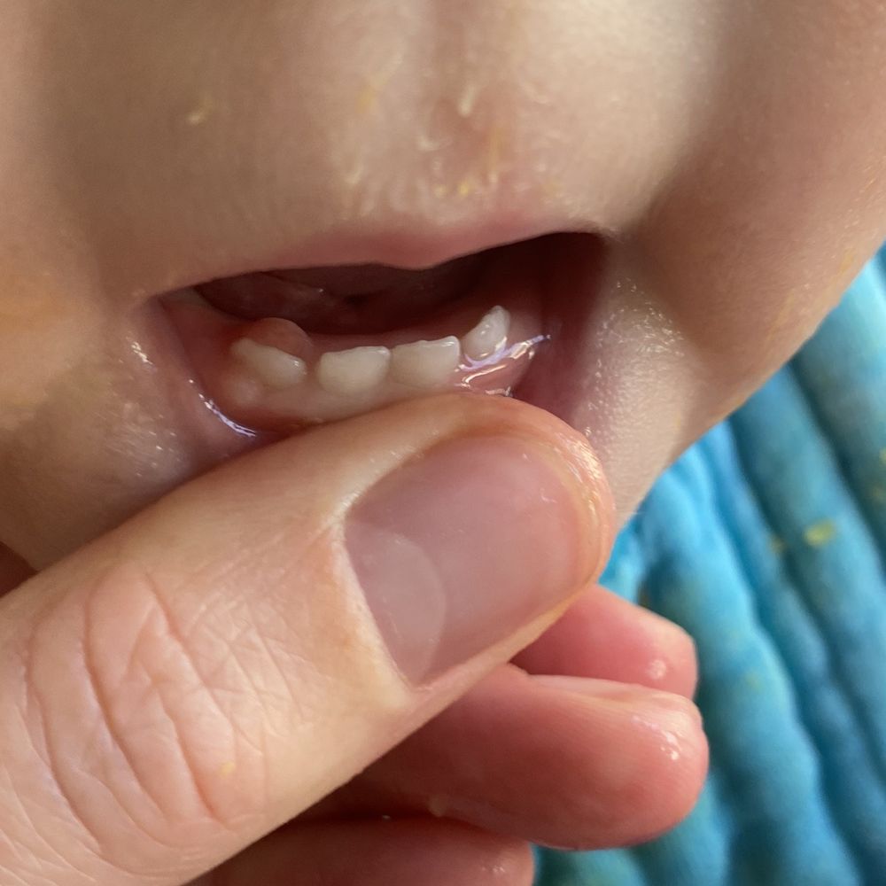 Davis Pediatric Dentistry - Pediatric Dentists Near Me - Encinitas, California Davis Pediatric Dentistry - Pediatric Dentists Near Me - Encinitas, California