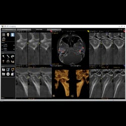 Northwest Oral & Facial Surgery - Computer Guided Imaging