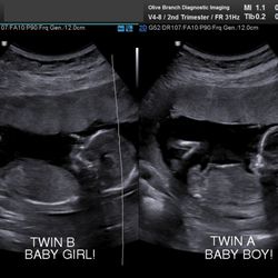 Oh Baby - Twins