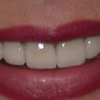 Woodside Dental - Cosmetic Dentists Near Me - Los Angeles, California Woodside Dental - Cosmetic Dentists Near Me - Los Angeles, California