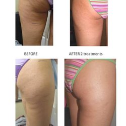 Advanced Anti-aging & Weight Loss