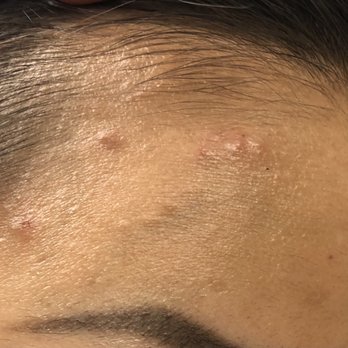 Back Bay Skincare & Spa - July 15 - Skin Care Near Me - Boston, Massachusetts