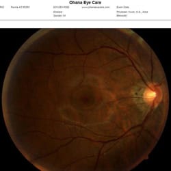 Ohana Eye Care - Retinal photos