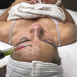 Brow And Arrow - Bio Re Peel perfect Peel all year round instand results