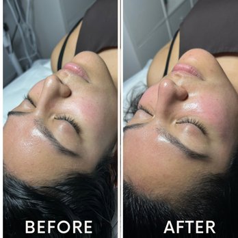 Laser Arts Studio - Happy client of LAS - Laser Hair Removal Near Me - Newburgh, New York Laser Arts Studio - Happy client of LAS - Laser Hair Removal Near Me - Newburgh, New York