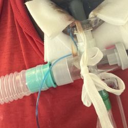 Cadia Healthcare - This the sort of care the use o give hours at a time no care