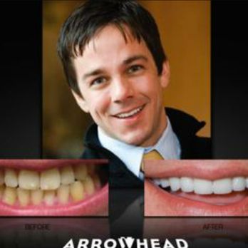 Las Sendas Dental Health - Before & After from Las Sendas Dental Health | Mesa, AZ - General Dentistry Near Me - Mesa, Arizona Las Sendas Dental Health - Before & After from Las Sendas Dental Health | Mesa, AZ - General Dentistry Near Me - Mesa, Arizona
