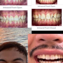 Before & afters