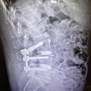 Burdi Michael D MD - Orthopedists Near Me - Mission Viejo, California