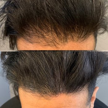 The Ink Stylist. - Hair Loss Centers Near Me - Toronto, Ontario The Ink Stylist. - Hair Loss Centers Near Me - Toronto, Ontario