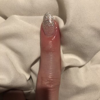 VIP Nails & Spa - The infected finger. - Nail Salons Near Me - Lodi, California VIP Nails & Spa - The infected finger. - Nail Salons Near Me - Lodi, California