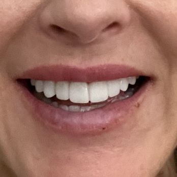 Smile Maker of Texas - Cosmetic Dentists Near Me - Plano, Texas Smile Maker of Texas - Cosmetic Dentists Near Me - Plano, Texas