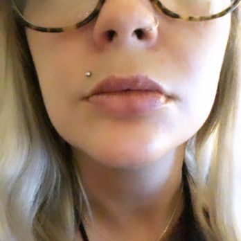 Stay Gold - I went to see Brigitte for hyaluron pen lip injections and WOW! - Spray Tanning Near Me Stay Gold - I went to see Brigitte for hyaluron pen lip injections and WOW! - Spray Tanning Near Me