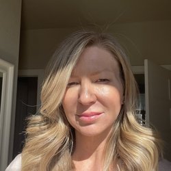 The Natural Place Med Spa - A few days after a Pico/Q-switch laser treatment.