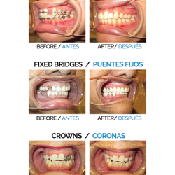 Precision Dental Care