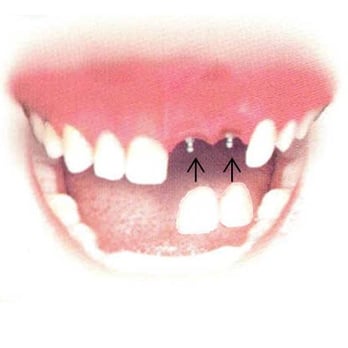 Luz E Cabrera, DMD - General Dentistry Near Me - Temple Terrace, Florida Luz E Cabrera, DMD - General Dentistry Near Me - Temple Terrace, Florida