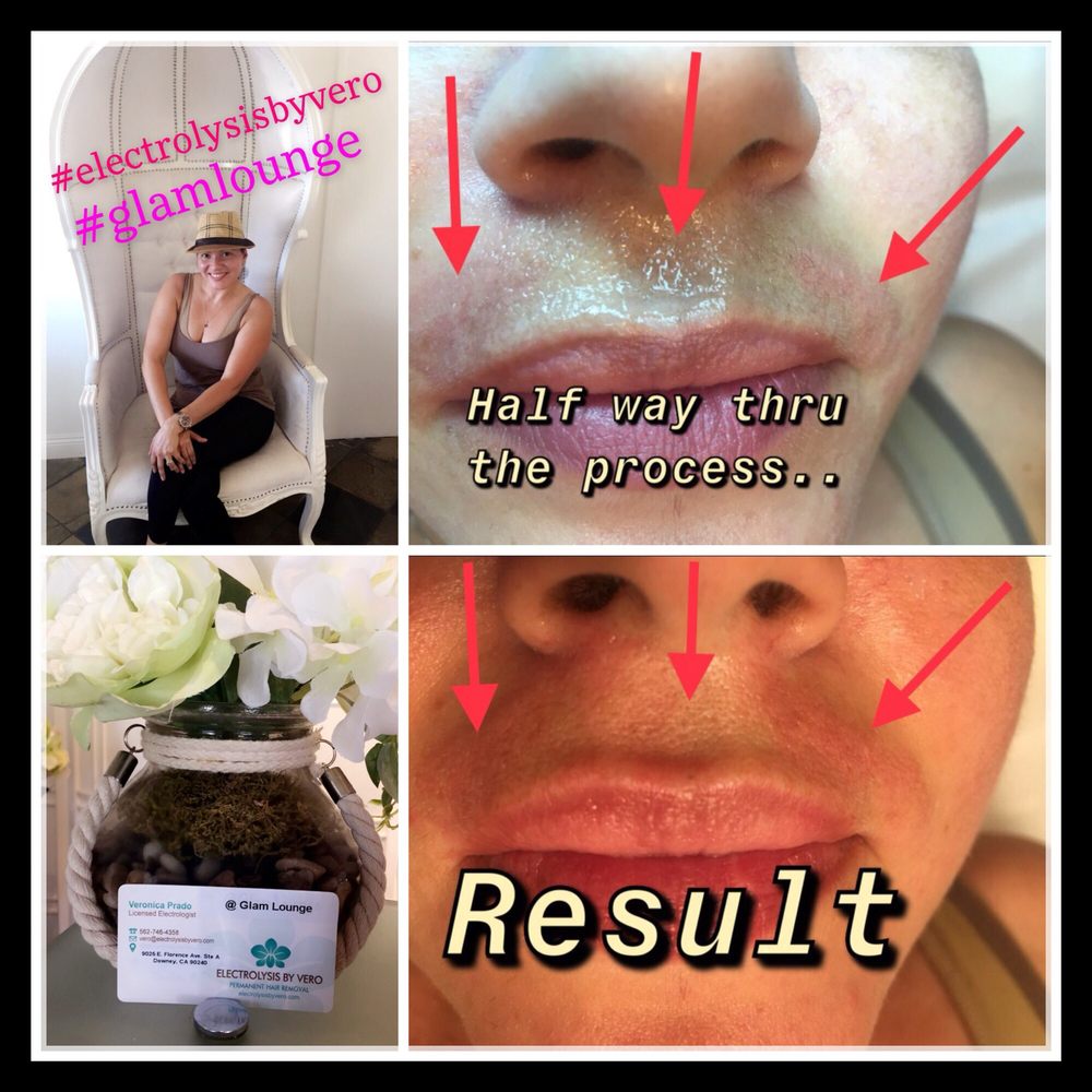 ELECTROLYSIS BY VERO 11 Photos 9025 E Florence Ave, Downey