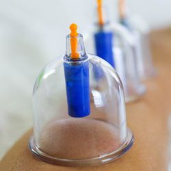 Optimal Massage - 30/60/90 min. or 2 Hour Optimal Massage with Cupping