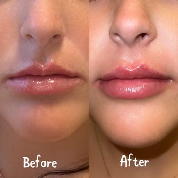 VIP Plastic Surgery - Cosmetic Surgeons Near Me - Henderson, Nevada