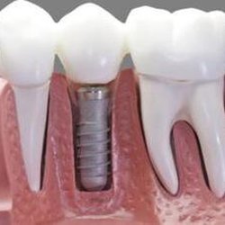 Crest Hill Family Dental - Untitled