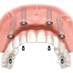 Hanuman Oral Surgery Care